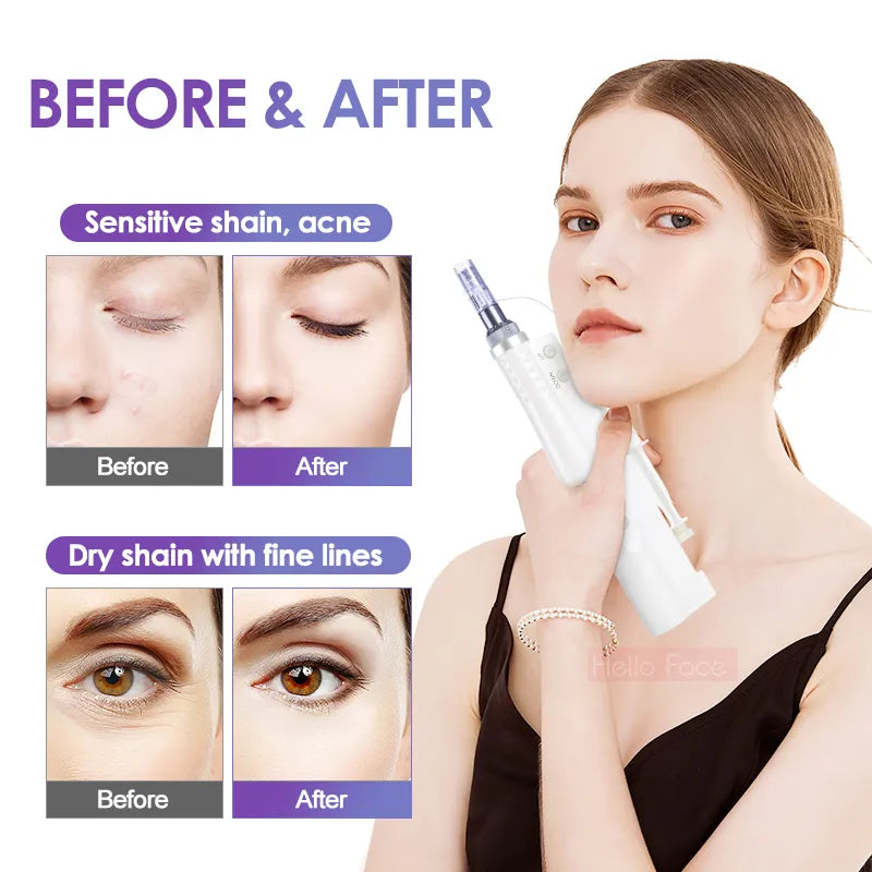 2-in-1 Hydra Whitening Injector with Aqua Derma Pen